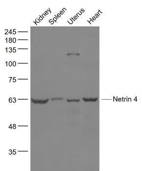 Netrin 4 Rabbit Polyclonal Antibody