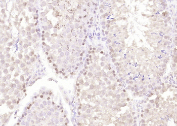 Cyclin E2 Rabbit Polyclonal Antibody