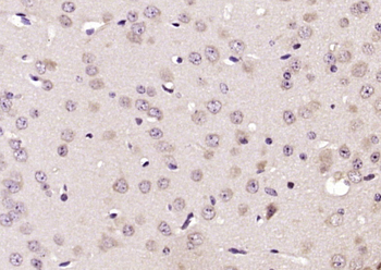 SPRED2 Rabbit Polyclonal Antibody