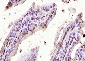 Cofilin Rabbit Polyclonal Antibody