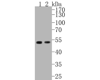 Cyclin E1 Recombinant Rabbit Monoclonal Antibody
