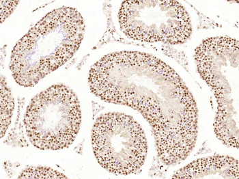 Cyclin E1 Recombinant Rabbit Monoclonal Antibody