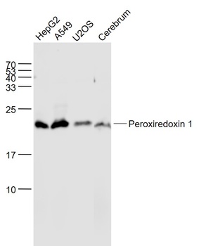 Peroxiredoxin 1 antibody