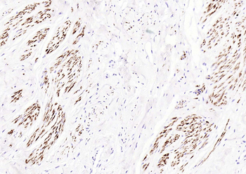 Desmin (ready to use) Mouse Monoclonal Antibody