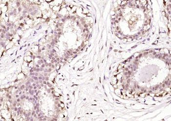 S100B Rabbit Polyclonal Antibody