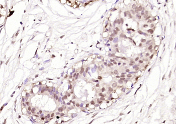 S100B Rabbit Polyclonal Antibody