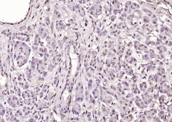 S100B Rabbit Polyclonal Antibody