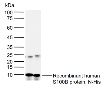 S100B Rabbit Polyclonal Antibody