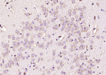 MAP4 Rabbit Polyclonal Antibody