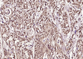 PTN Rabbit Polyclonal Antibody