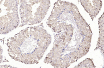 SOX6 Rabbit Polyclonal Antibody