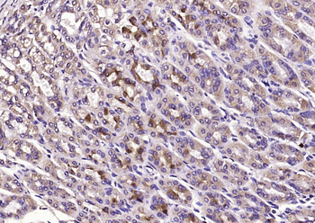 MCP1 Rabbit Polyclonal Antibody