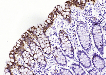 CK20 (ready to use) Mouse Monoclonal Antibody