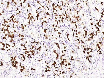 MUC6 (ready to use) Mouse Monoclonal Antibody