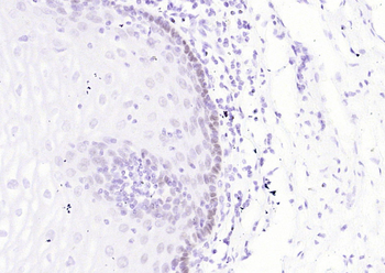 P63 (ready to use) Mouse Monoclonal Antibody