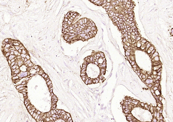 Pan Cytokeratin (ready to use) Mouse Monoclonal Antibody