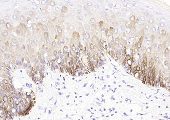 CK14 (ready to use) Mouse Monoclonal Antibody