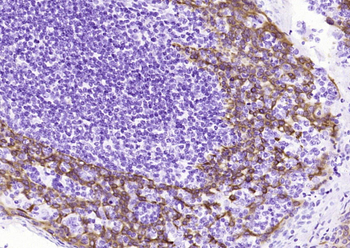 CK14 (ready to use) Mouse Monoclonal Antibody