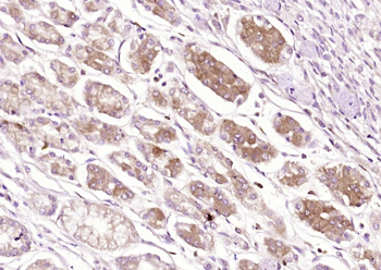 SSTR4 Rabbit Polyclonal Antibody