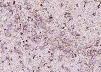PRKD1/PKC mu Rabbit Polyclonal Antibody