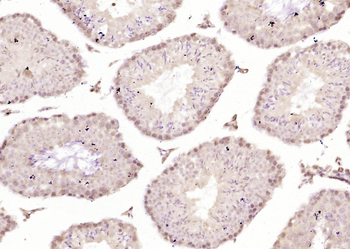 SOX6 Rabbit Polyclonal Antibody