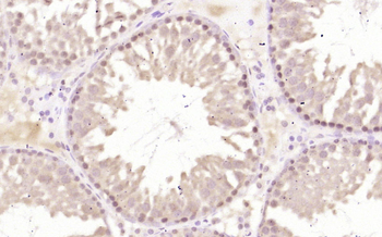 GCNF Rabbit Polyclonal Antibody