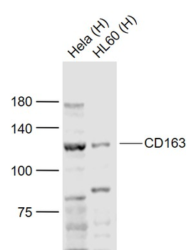 CD163 Rabbit Polyclonal Antibody