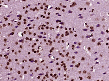 JNK3/MAPK10 Rabbit Polyclonal Antibody
