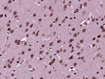 JNK3/MAPK10 Rabbit Polyclonal Antibody