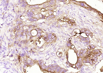 CEA (ready to use) Mouse Monoclonal Antibody