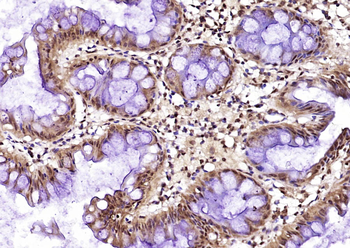 CK II beta Rabbit Polyclonal Antibody