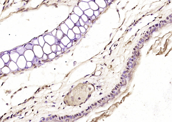 Axin1 Rabbit Polyclonal Antibody