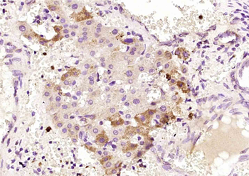 Hexokinase 3 Rabbit Polyclonal Antibody