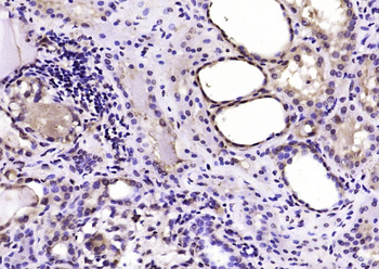 Nm23-H2/NME2 Rabbit Polyclonal Antibody