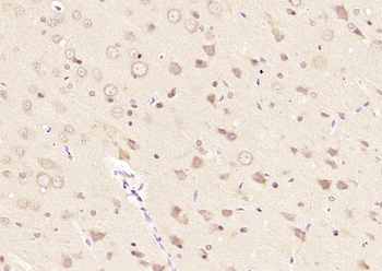 PRDX2 Rabbit Polyclonal Antibody