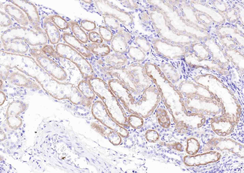 PRDX2 Rabbit Polyclonal Antibody