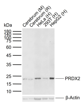 PRDX2 Rabbit Polyclonal Antibody
