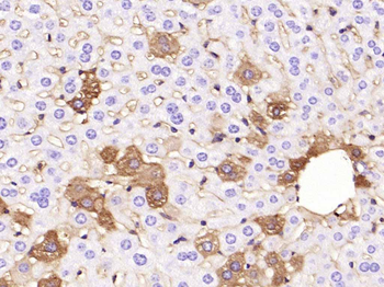 ANGPTL8 Mouse Monoclonal Antibody