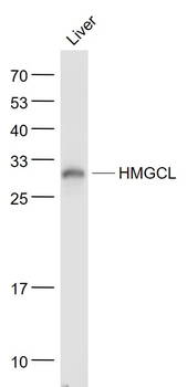 HMGCL Rabbit Polyclonal Antibody