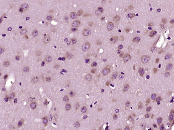 HMGCR Rabbit Polyclonal Antibody