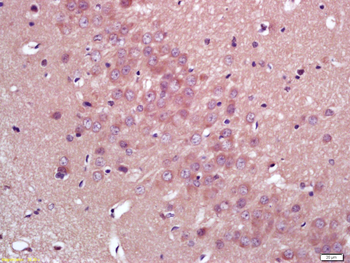 HMGCR Rabbit Polyclonal Antibody