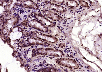 HNF4A Rabbit Polyclonal Antibody