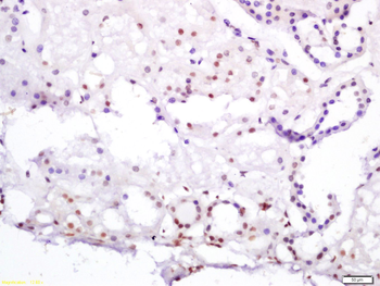 HNF4A Rabbit Polyclonal Antibody