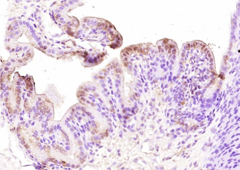 HOXB4 Rabbit Polyclonal Antibody