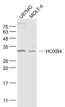 HOXB4 Rabbit Polyclonal Antibody