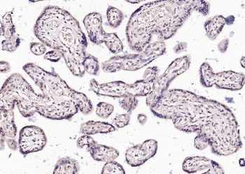 HSF1 Rabbit Polyclonal Antibody