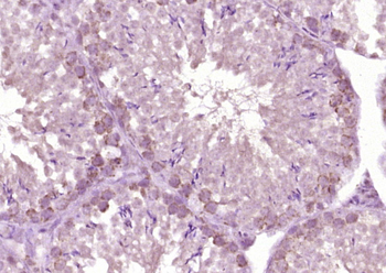 HSD17B3 Rabbit Polyclonal Antibody