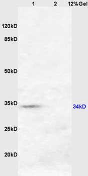 HSD17B3 Rabbit Polyclonal Antibody
