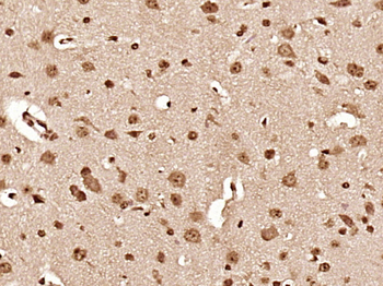 Hsc70 Rabbit Polyclonal Antibody