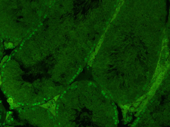 Phospho-HSP90 alpha (Thr5 + Thr7) Rabbit Polyclonal Antibody